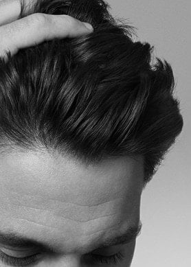 tudo-o-que-voce-precisa-saber-sobre-caspa-aderente